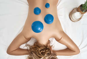 Vacuum cups for cupping therapy on the back of a topless woman, top view