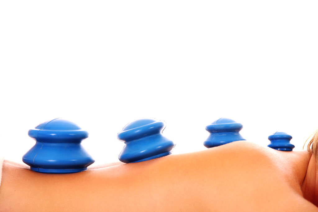 A picture of young woman's back with blue massage cups over white background